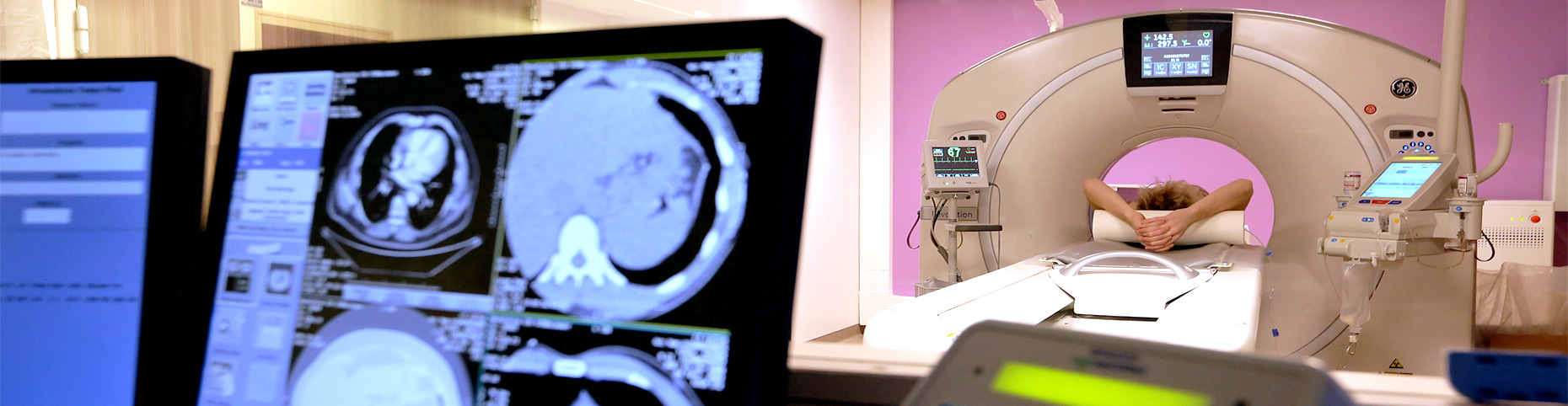 scanner imagerie médicale nancy